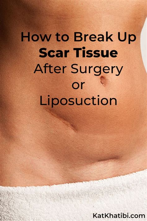 Bumpy and Lumpy Appearance After Bad Liposuction. . Hard lumps after liposuction